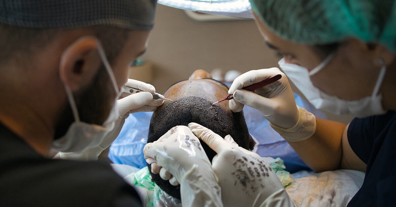 tricopigmentation sur un patient