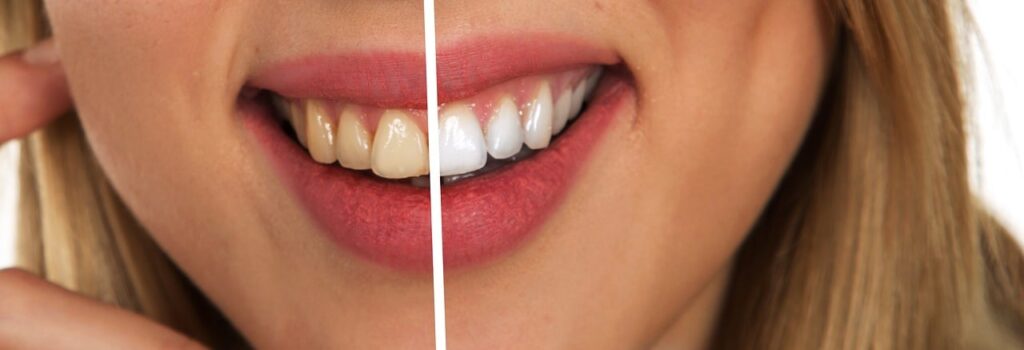 dentifrice blanchissant