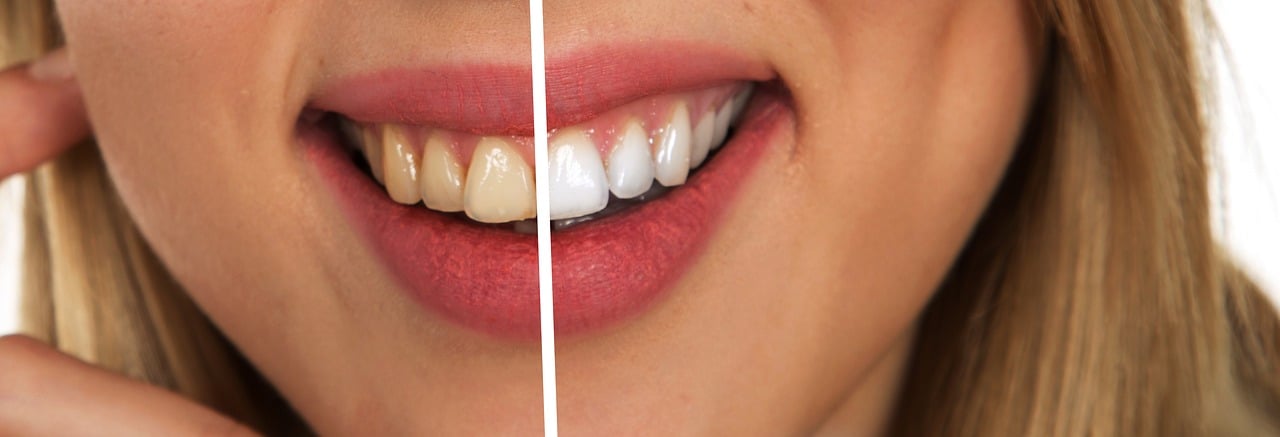 dentifrice blanchissant